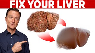 The 6 Best Ways to Heal a Fatty Liver [upl. by Eitsyrk]