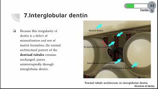 DENTIN COURSE  11  Intergolbular Dentin [upl. by Leerzej]