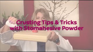 Crusting Tips and Tricks with Stomahesive Powder [upl. by Kelley884]