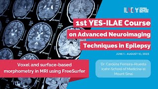 4th Lecture Surfacebased morphometry in MRI using FreeSurfer [upl. by Mcclenaghan]