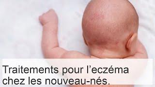 Traitement de la dermatite atopique chez les enfants avec crèmes hormonales et non hormonales [upl. by Solokin]