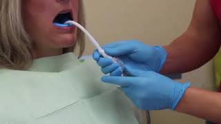 Septodont Fluocal Fluoride Gel  How to Use  DENTBEAR [upl. by Kernan]