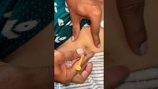 How to give SC injection 💉😱docter trendingshorts viralshorts [upl. by Leind917]