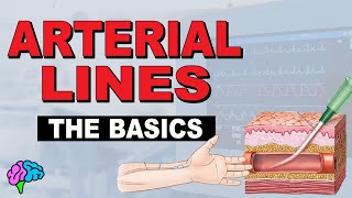 What is an Aline Arterial Line Basics EXPLAINED [upl. by Tarton886]