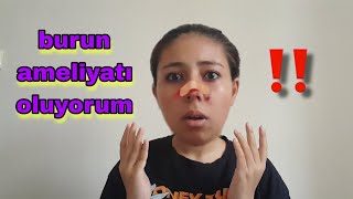 BURUN AMELİYATI OLUYORUM [upl. by Ronyar]