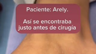 Testimonio Arely [upl. by Craddock]