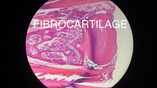 FIBROCARTILAGE [upl. by Davis661]