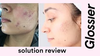 Glossier Solution Review [upl. by Akehsar524]