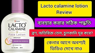 Lacto calamine face lotion reviewLacto calamine face lotion review in Bengali [upl. by Analise557]