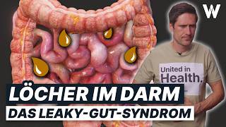 LeakyGutSyndrom  Durchlässiger Darm Kenne die Symptome und stärke Deine Darmgesundheit [upl. by Thanh]