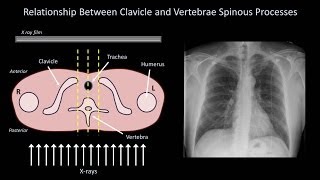 How to Interpret a Chest XRay Lesson 3  Assessing Technical Quality [upl. by Nosreffej654]