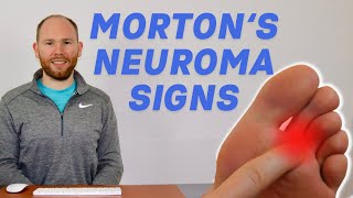 10 Signs You May Have a Mortons Neuroma by a Foot Specialist [upl. by Ansel]