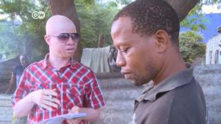 Albino journalist fights deadly stereotype  Africa on the Move [upl. by Romelle]