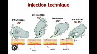 Injection Techniques quotIntermuscular Subcutaneous Intravenous Intradermalquot [upl. by Ardet942]