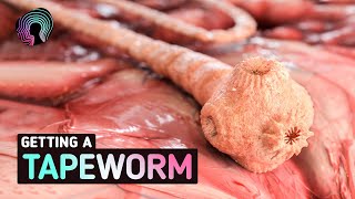 What Happens When You Get Tapeworms Warning distressing footage [upl. by Oirotciv725]