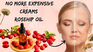 Amazing Benefits Of Rosehip Oil Rosehip Oil Uses On Skin and Hairs [upl. by Jarred175]