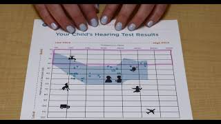 How to read an audiogram [upl. by Adnawyek]