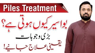 Piles Causes amp Treatment  Khooni Aur Badi Bawasir Ka Ilaj  By Dr Idrees Gondal [upl. by Almira]