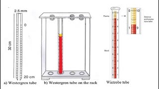 Erythrocyte Sedimentation RateESR Westergren method Vs Wintrobe’s method joenacademy [upl. by Snilloc]