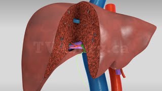 Liver transplant Living donor right hepatectomy donor procedure [upl. by Meean189]