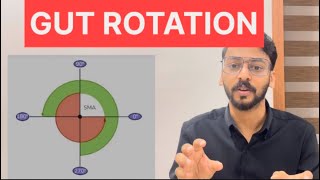 Gut Rotation Anatomy Malayalam LectureOmphalocele [upl. by Hestia]