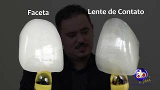 Facetas e Lentes de Contato Dentais qual a diferença [upl. by Nancy]