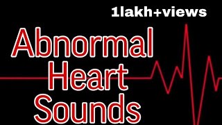 Abnormal Heart Sounds  MisMedicine [upl. by Burra]