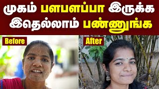 Pimple Solutions எந்நேரமும் முகம் பளபளப்பா இருக்கணும்னா இத பண்ணுங்க  Face Problem Solutions  TI [upl. by Ecinehs853]