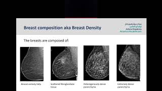 Screening Mammogram Understanding your Mammogram Report [upl. by Elicul459]