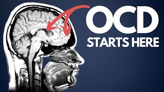 OCD explained for beginners  how I wish I was taught [upl. by Anaert]