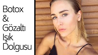 İLK BOTOX VE GÖZALTI IŞIK DOLGUSU DENEYİMİM  Öncesi Sonrası ve Fiyatlar [upl. by Enisamoht]