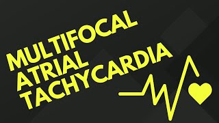 Multifocal Atrial Tachycardia ⏬👇 [upl. by Akamaozu]