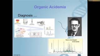 Organic Acidemia Overview and clinical presentation Dr Maha Alotaibi [upl. by Annohs57]