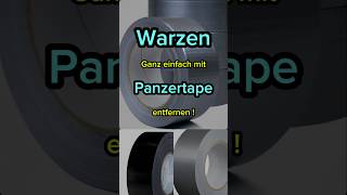 Warzen mit Panzertape entfernen gesundheit tips diy beauty fyp haut fürdich [upl. by Saffren706]