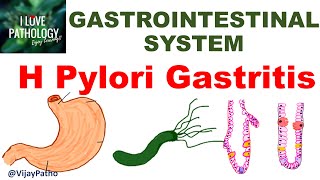 H Pylori Gastritis  Epidemiology Pathogenesis Clinical features Sequelae amp Treatment [upl. by Benoit]