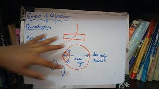 ERRORS OF REFRACTION general inroduction with important points [upl. by Wiggins]