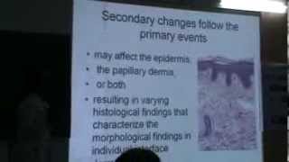 Lecture on Interface dermatitis By DrShashikalaP  CME DERMATOLOGY [upl. by Standley508]