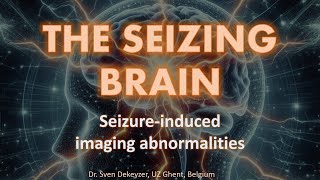 The Seizing Brain  Seizureinduced imaging abnormalities on perfusionCT and MRI [upl. by Melisande]