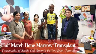 Half match Bone Marrow Transplant  Haploidentical  Sickle Cell Anemia Patient from Uganda [upl. by Regine]