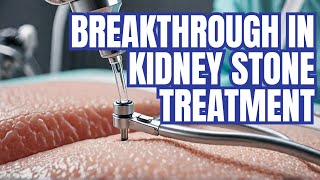 quotRevolutionary Minimally Invasive Kidney Stone Treatments Benefits Procedures and Effectivenessquot [upl. by Gnivri]