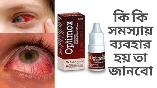 Optimox eye drop চোখের ড্রপ কি কি সমস্যায় ব্যবহার হয় তা জানবো healthtips [upl. by Eislehc]