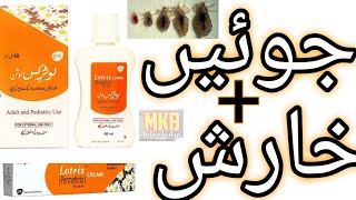 The SHOCKING Truth About Lotrix Lotion Urdu [upl. by Bouldon362]