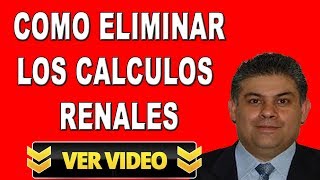 Como Eliminar Los Calculos Renales  3 Consejos para Eliminar los Calculos Renales [upl. by Australia836]