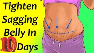 Get Rid Of Sagging Belly At Home  Tighten Sagging Belly In 10 Days [upl. by Lazos]