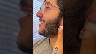 Pimple popping  pimple blackheads amp blackheads treatment [upl. by Nikolaos]