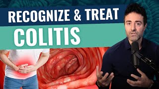 What Ulcerative Colitis Is amp How You Can Treat It Effectively [upl. by Leland]