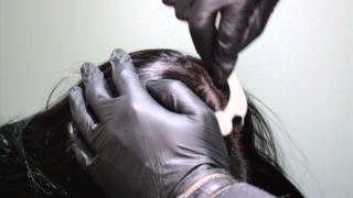 Mesotherapy  For Hair Regrowth and Hair Rejuvenation [upl. by Llenral]