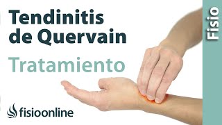 Tendinitis de De Quervain  Tratamiento con ejercicios automasajes y estiramientos [upl. by Aicnelav]