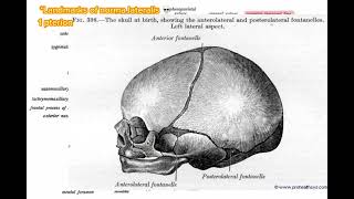 Pterion norma lateralis anatomy skull headandneckanatomy [upl. by Florette]