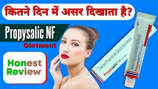 Propysalic NF Ointment  Clobetasol And Salicylic Acid Ointment Uses  Salicylic Acid For Face [upl. by Atiuqam]